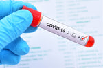 TEST ANTICORPS COVID-19 ( IGA - IGG - IGM )  (EN CLINIQUE) - Medfuture